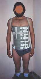 corset