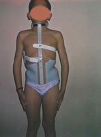 corset